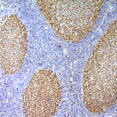 Ki-67 Antigen; Polyclonal (Ready-To-Use)